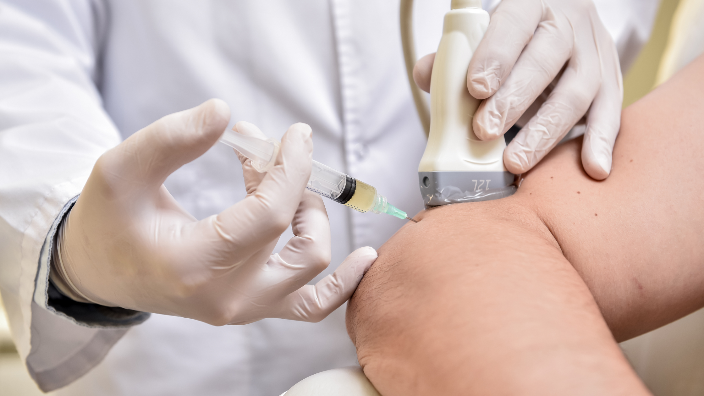 ultrasound-guided cortisone injections