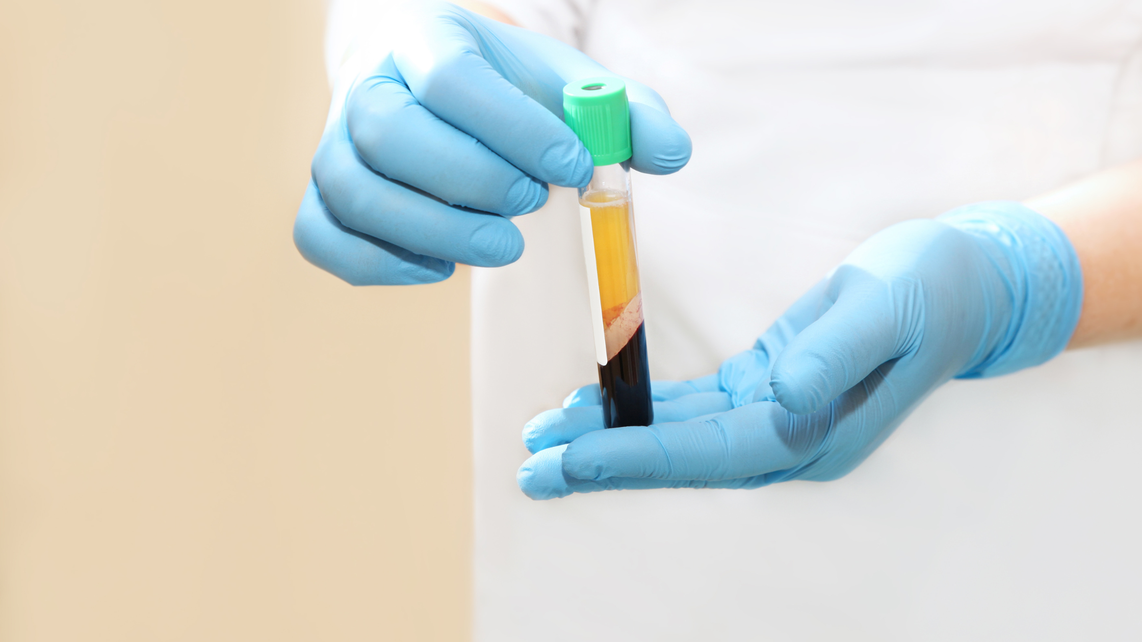 PRP therapy for joint pain