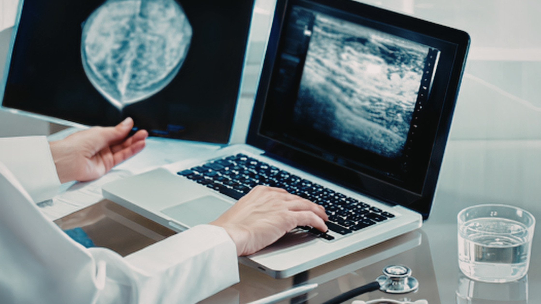 diagnostic ultrasound