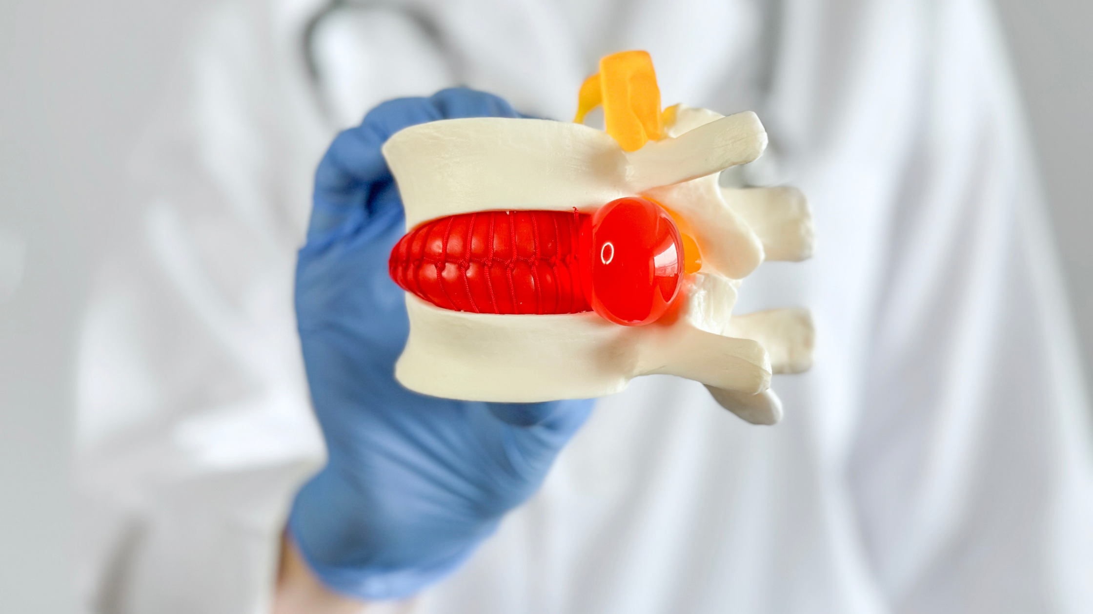 herniated disc